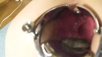 Live eel anal insertion with speculum 2