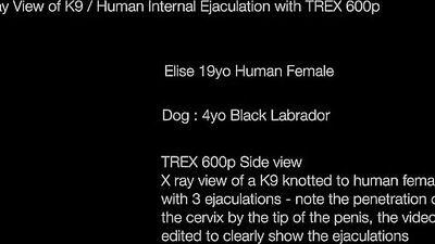 Elise X-Ray