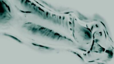 Elise X-Ray