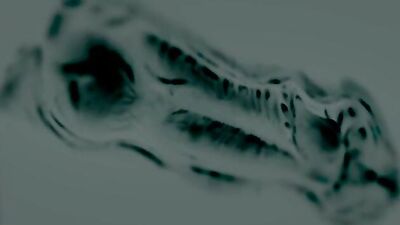 Elise X-Ray
