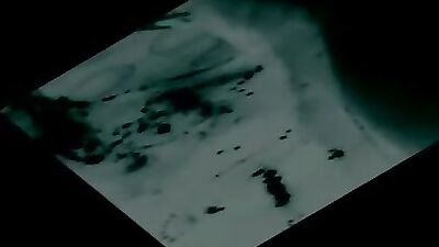 X Ray view