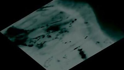 X Ray view