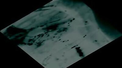X Ray view