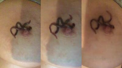 Worm in the nipples