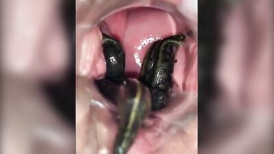 leeches in pussy 03