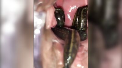 leeches in pussy 03