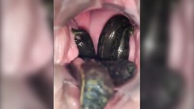 leeches in pussy 03
