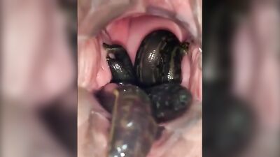 leeches in pussy 03