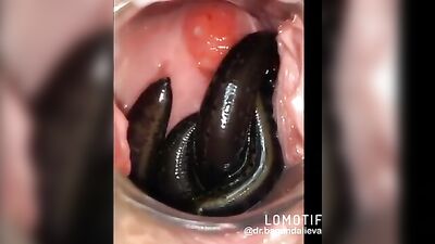 leeches in pussy