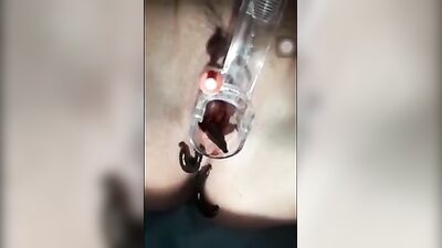 leaches in pussy 01