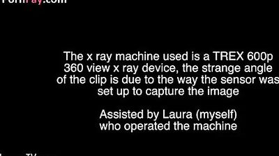 X ray Elise full version