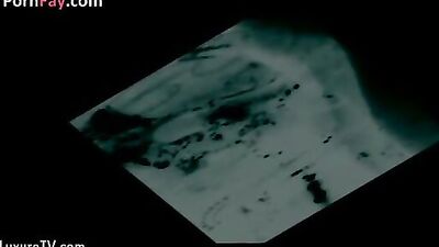 X ray Elise full version