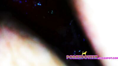 Girl Endoscope Fill up COMPILATION