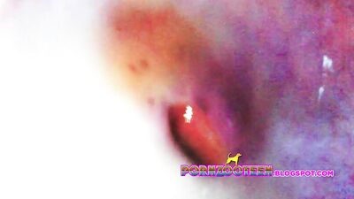 Girl Endoscope Fill up COMPILATION