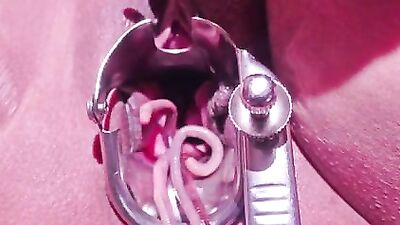 Worms