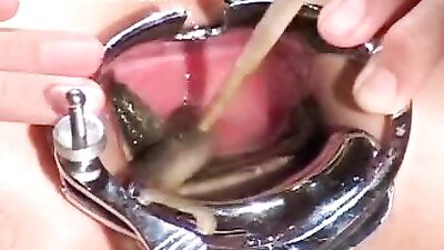 Eels slippery anal invasion with speculum probe