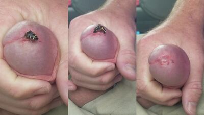 Wasp Sting Makes Me Cum